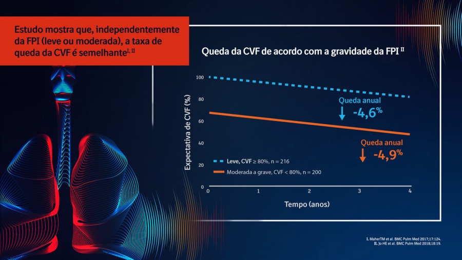 Queda da CVF na FPI Queda da CVF na FPI