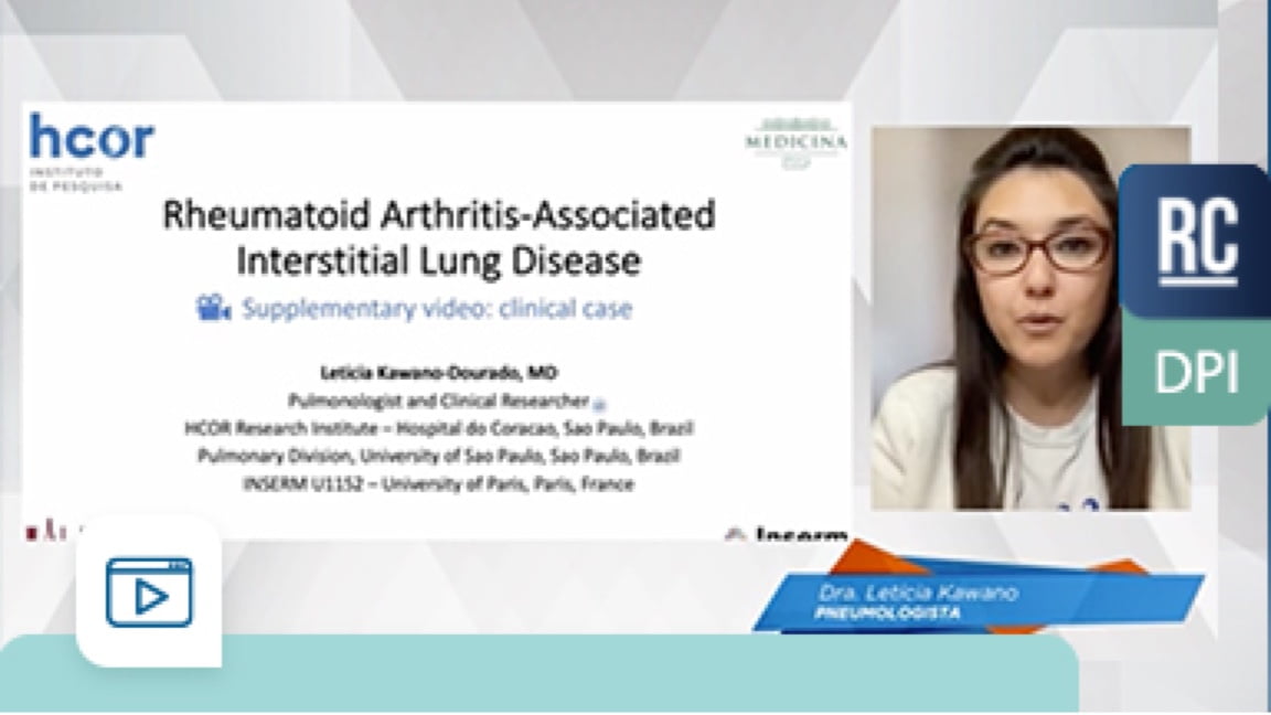Caso clínico em Artrite Reumatoide – Leticia Kawano | 8º ILD Summit 2022