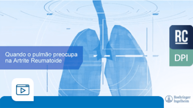 Aula 6 - Quando o pulmão preocupa na Artrite Reumatoide? - Dra. Licia Mota