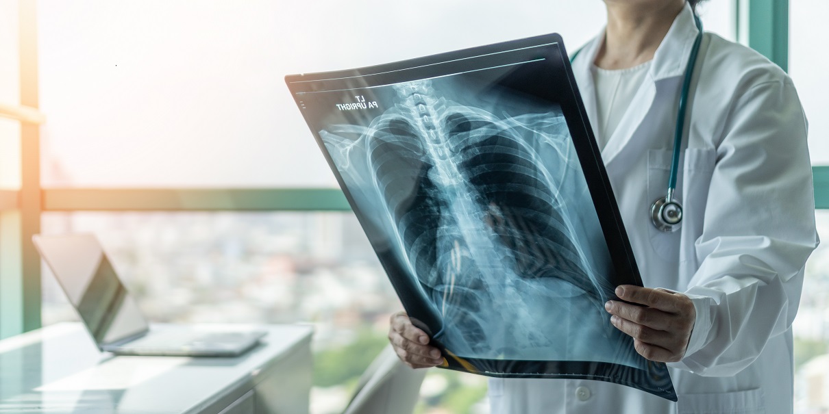 Doenças pulmonares fibrosantes progressivas – onde o radiologista pode ajudar?