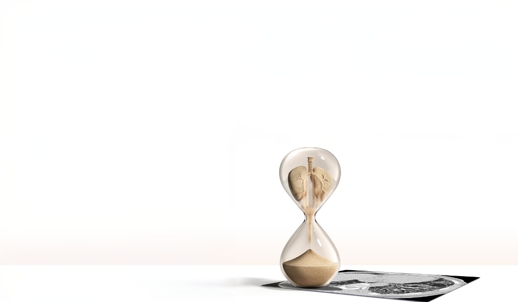 Fibrose Pulmonar ldiopática