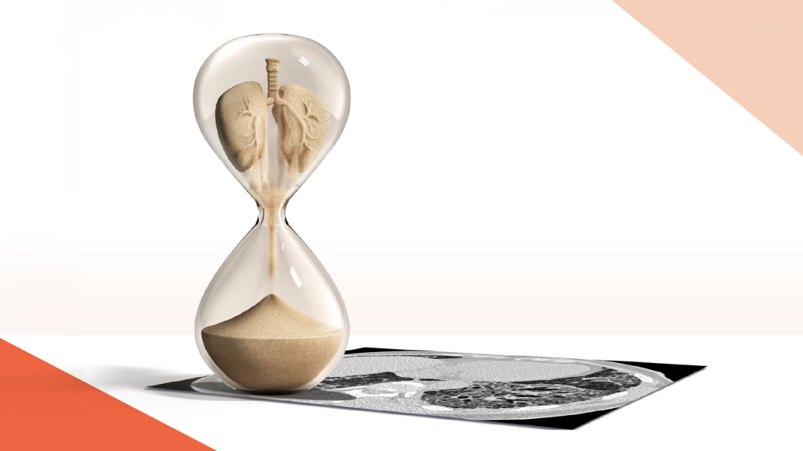 Intervenções nas DPIs