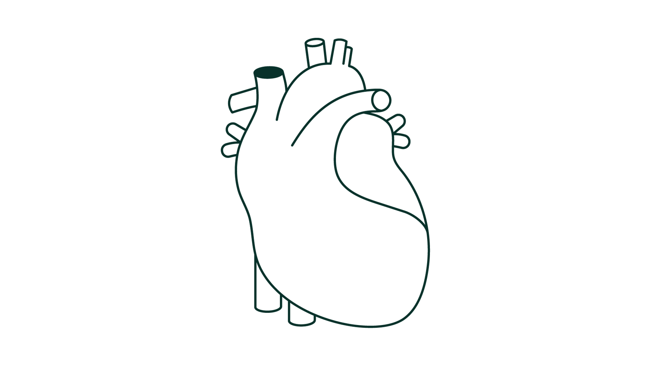 Infarto Agudo do Miocárdio