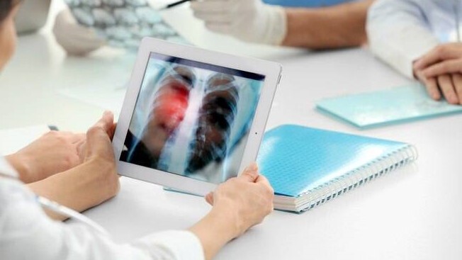 Ensaio de um inibidor da fosfodiesterase 4B