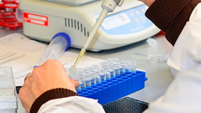 Preferências do paciente para o tratamento da doença pulmonar intersticial associada à esclerose sistêmica: um experimento de escolha discreta