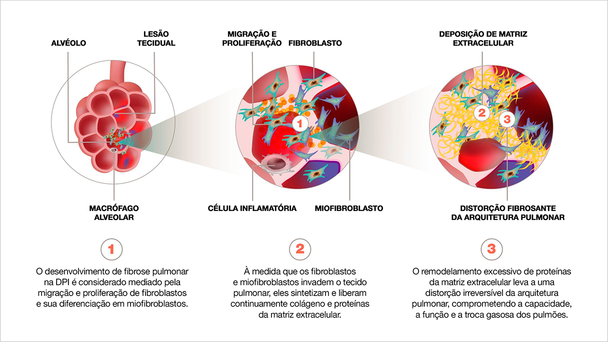 Para Reumatologistas