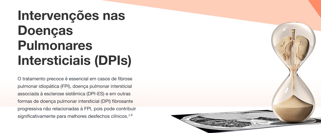 Intervenções nas Doenças Pulmonares Intersticiais (DPIs)