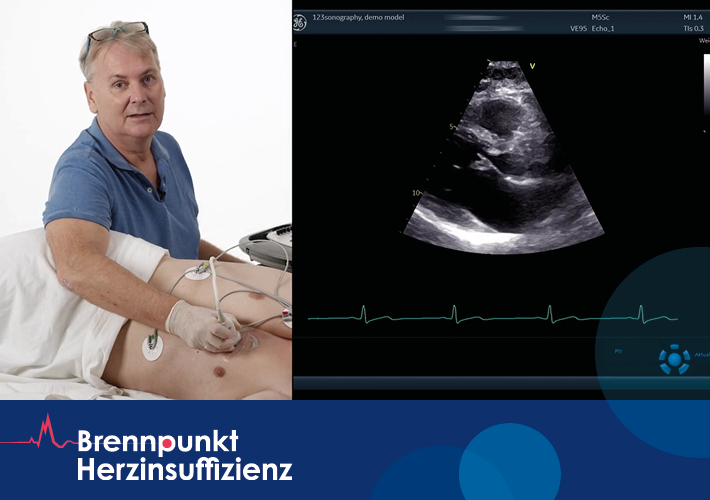 Brennpunkt Herzinsuffizienz – Kurs „Echokardiographie“ mit Univ. Prof. Dr. Thomas Binder