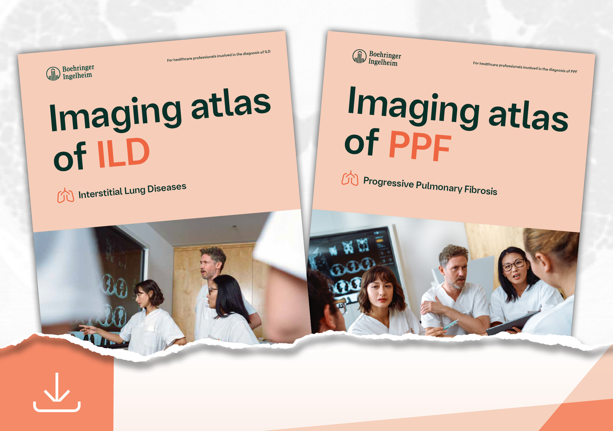 HRCT Bildatlanten für ILD und PPF