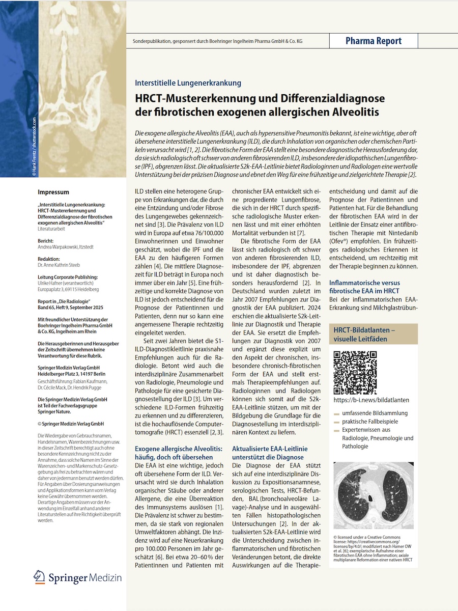 Aktuelle Sonderpublikation zur Differenzialdiagnose bei EAA-ILD