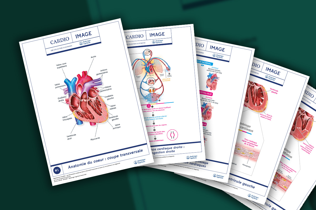 Banner collection planche