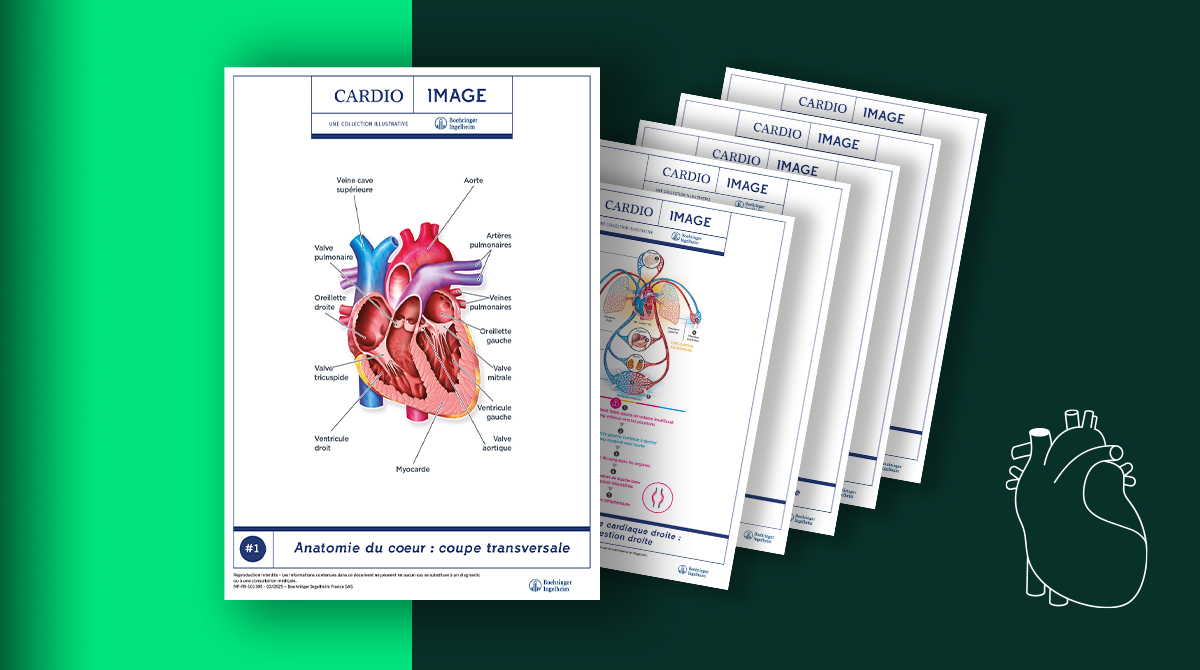 visuel teaser cardio-image