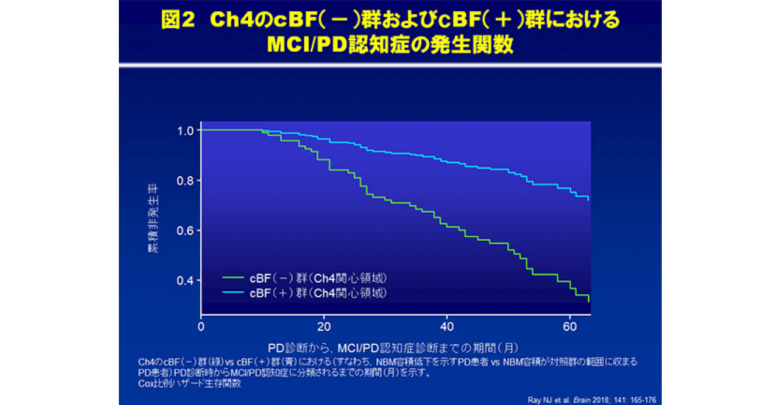 前脳基底核の萎縮と新規パーキンソン病の認知機能低下 Mirapex ミラペックス べーリンガープラス