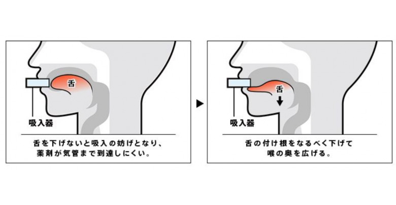 多職種連携によるチーム医療を目指して Spiolto スピオルト べーリンガープラス