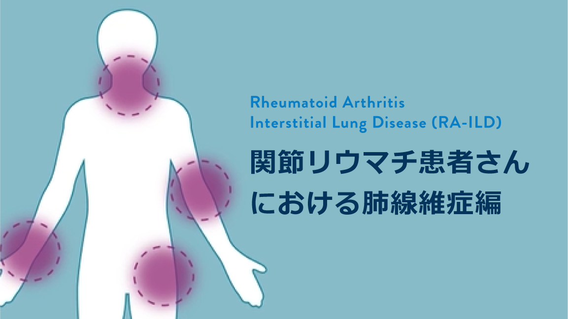 お知らせ／杉本 貴史らの症例報告が Acute Medicine & Surgery