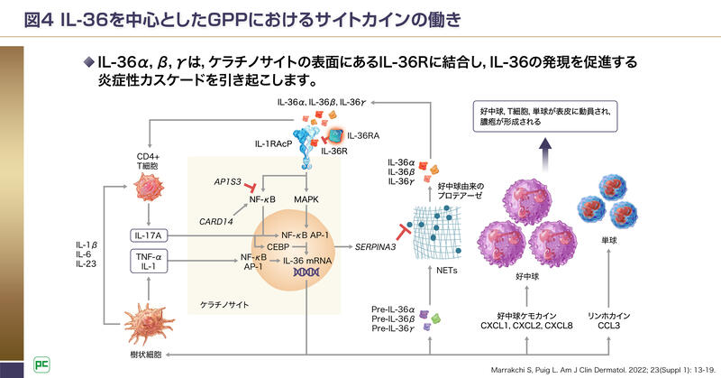 GPPの病態と関連するIL-36シグナル伝達経路