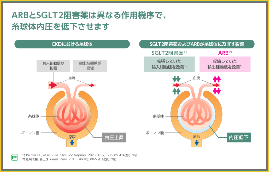 SGLT2阻害薬の腎保護作用の機序とジャディアンスの臨床成績 | べー