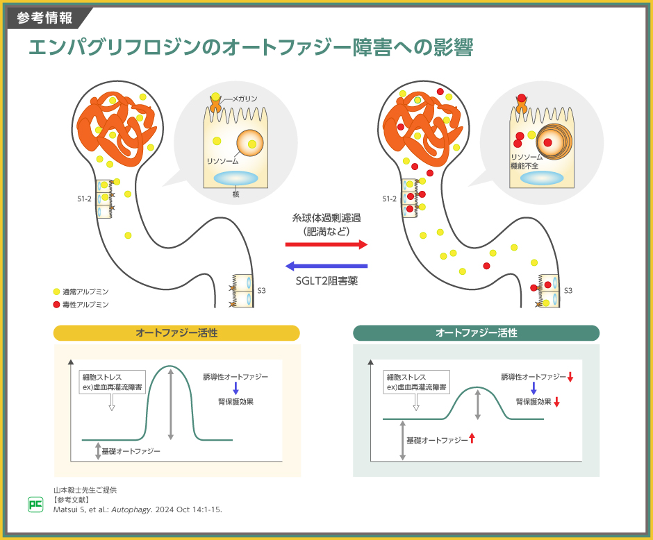 SGLT2阻害薬の腎保護作用の機序とジャディアンスの臨床成績 | べー