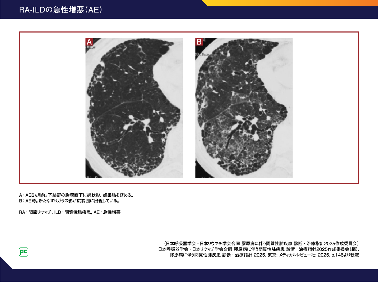 裁断済み　バイオ時代におけるリウマチ性疾患の診療 9784758118767.jpg