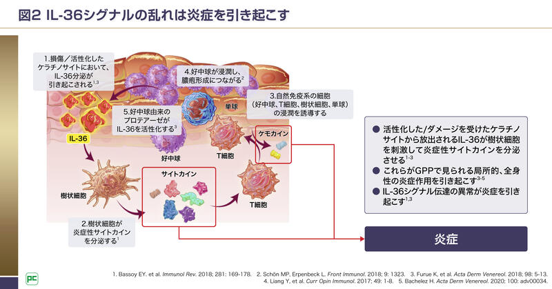 舌の乾癬の治療法にはどのようなものがありますか?