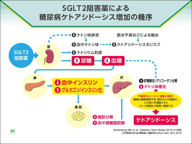 ケトアシドーシスの治療