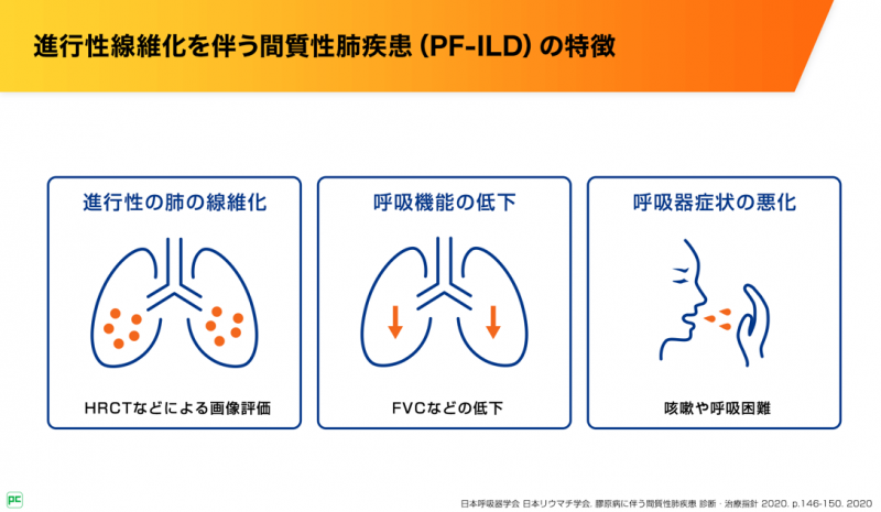 進行性線維化を伴う間質性肺疾患（PF-ILD）の特徴と治療アルゴリズム