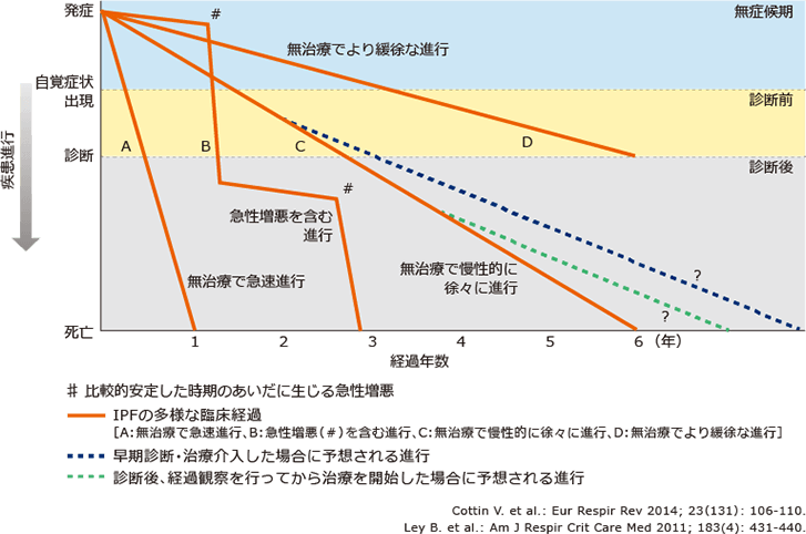 図1 IPFの臨床経過の多様性