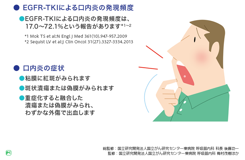 口内炎の発現頻度と症状