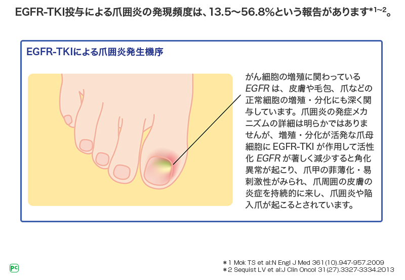 図1 EGFR-TKIによる爪囲炎発生機序の報告