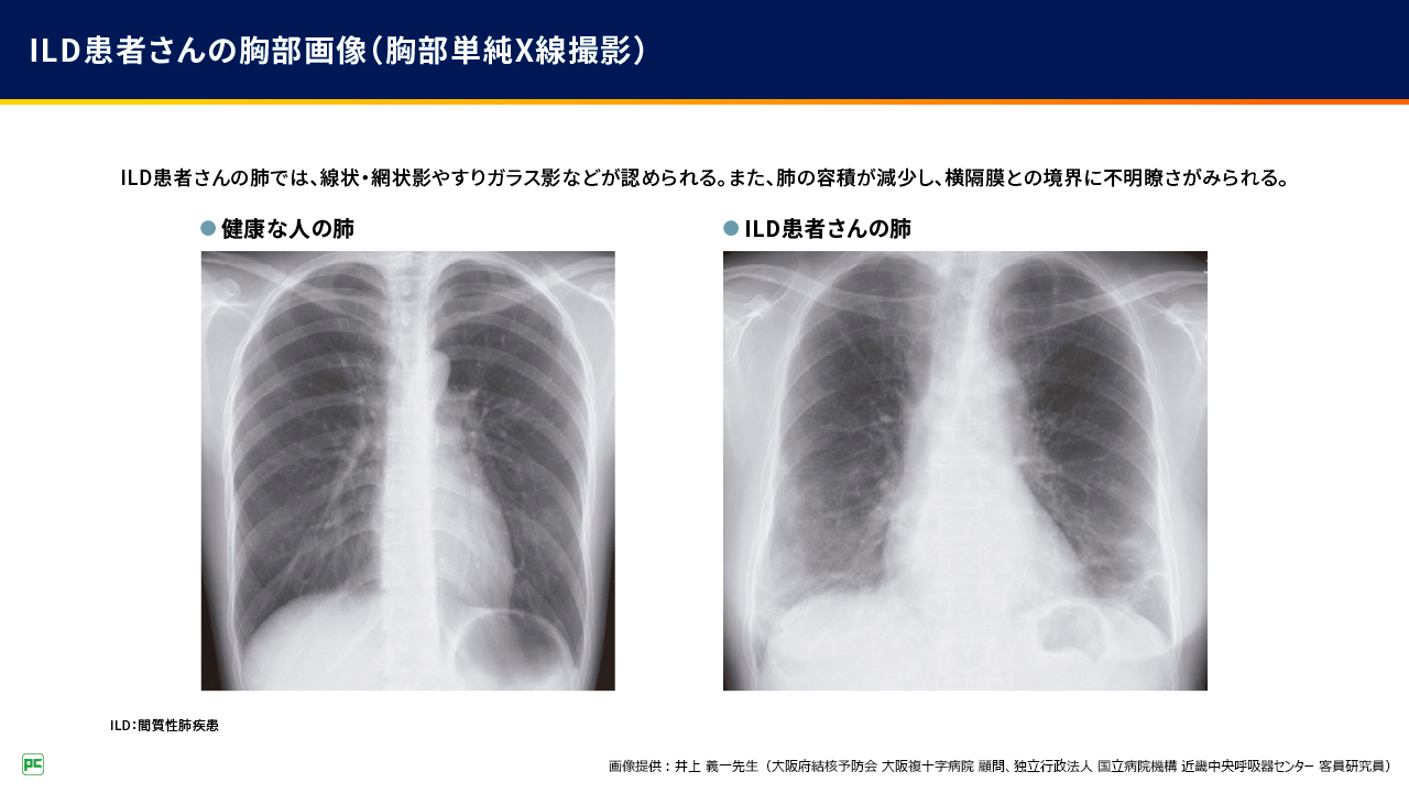 ハーネマンによる慢性病理論 Amazon.co.jp: 慢性病論 第2版 (ホメオパシー古典シリーズ