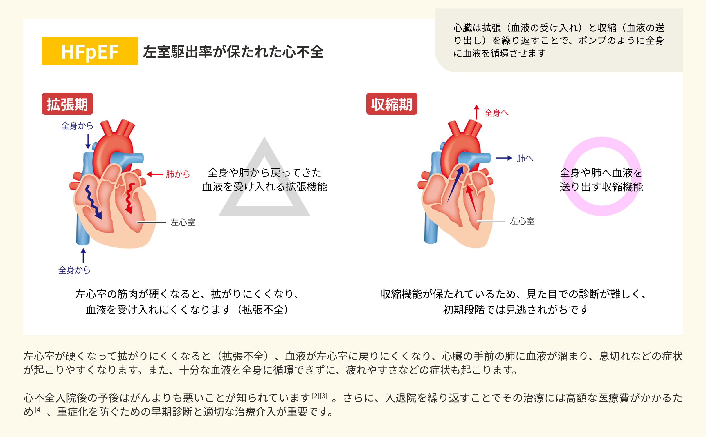 HFpEF診断計算ツール（BREATH₂スコア） | べーリンガープラス