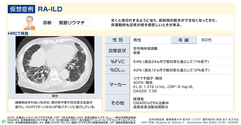 進行性線維化を伴うRA-ILDの診断と治療（静止画）02
