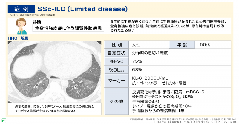 SScに伴う間質性肺疾患の診断と治療（Limited disease）静止画｜べー 