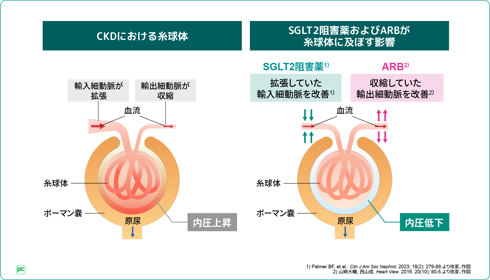 ARBで治療中の高血圧患者におけるCKD診療 | べーリンガープラス