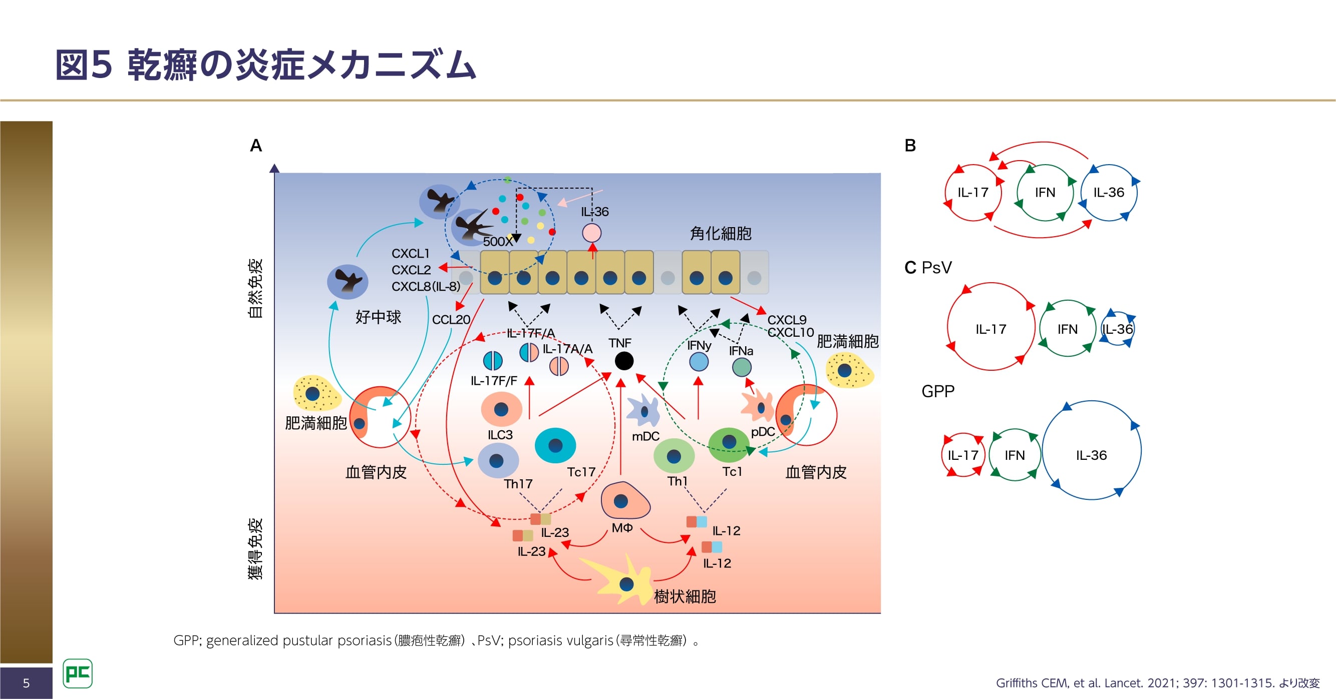 GPPとPsVの発症に寄与するシグナル伝達経路の違い