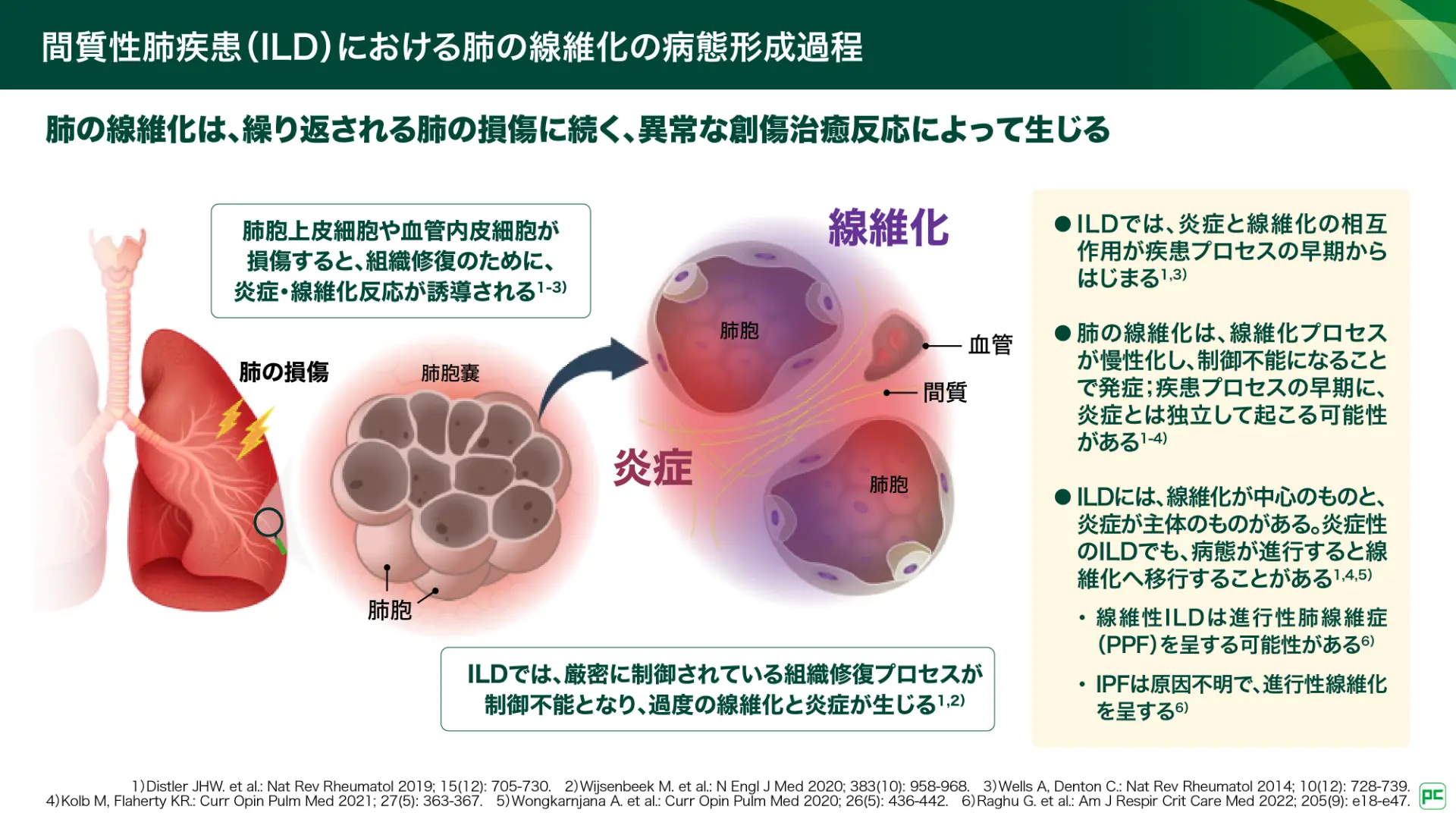 肺 線維 症