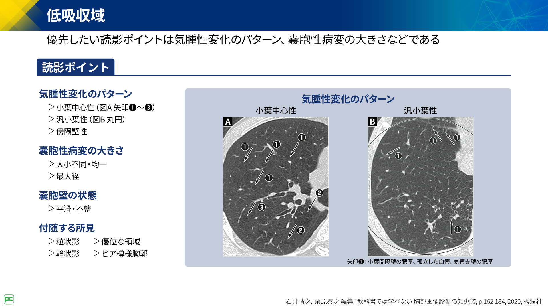 呼吸器疾患診療における胸部HRCT画像読影のポイント（静止画）｜べー 