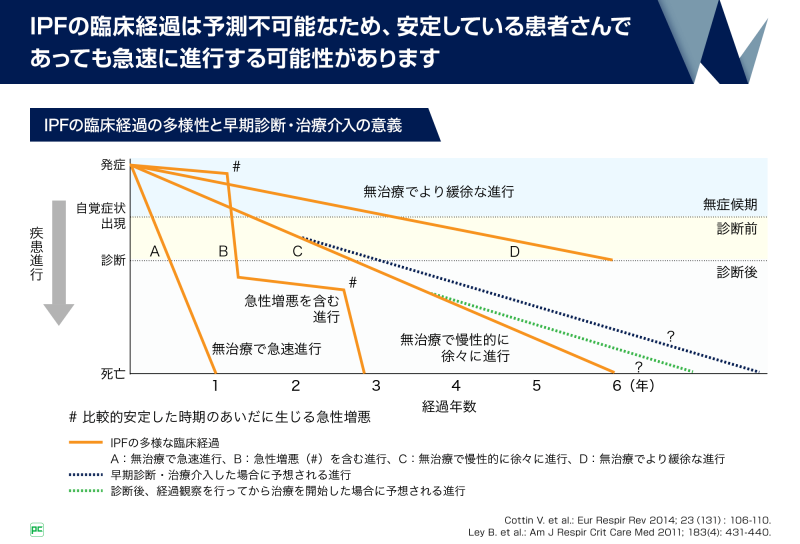 Pf Ildの早期診断 早期治療の重要性 静止画版 監修 札幌医科大学 名誉教授 即仁会北広島病院 札幌呼吸器医学研究所 所長 高橋 弘毅 先生 Ofev オフェブ べーリンガープラス