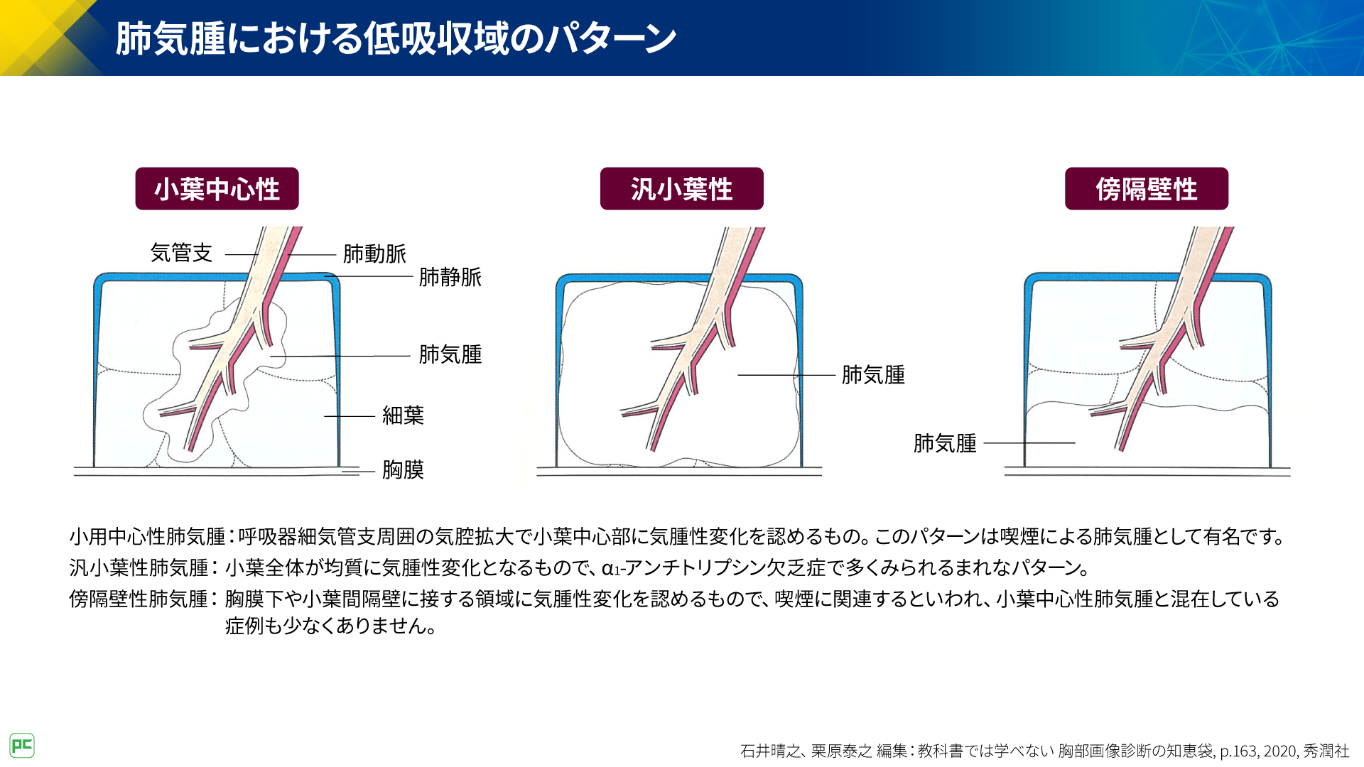 呼吸器疾患診療における胸部HRCT画像読影のポイント（静止画）｜べーリンガープラス