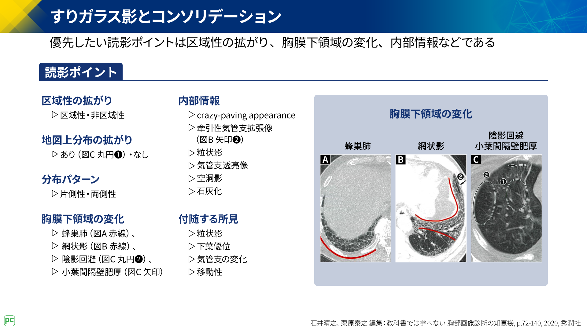 呼吸器疾患診療における胸部HRCT画像読影のポイント（静止画）｜べーリンガープ …