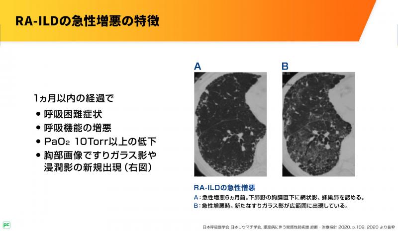 MS再発の治療が効果を発揮するまでに通常どれくらい時間がかかりますか?治療が効果があることをどうやって確認できますか?