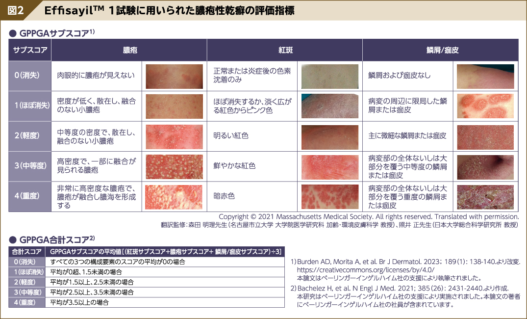 スペビーゴと母乳育児