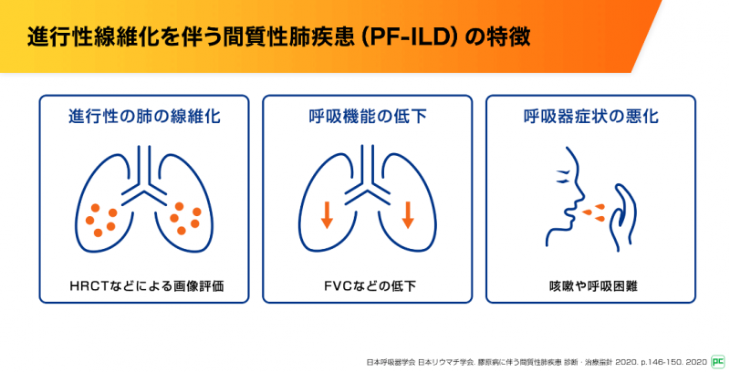 PF-ILDにおける症状の影響とオフェブの有用性（静止画版）｜べー 
