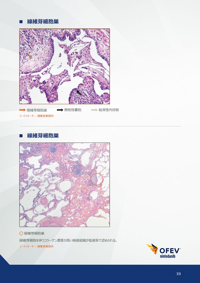 間質性肺疾患画像アトラス病理組織編