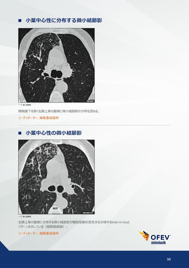 肺HRCT 原書5版 Amazon.co.jp: 肺HRCT 原書5版 : 西村 直樹, 松迫 正樹, 仁多
