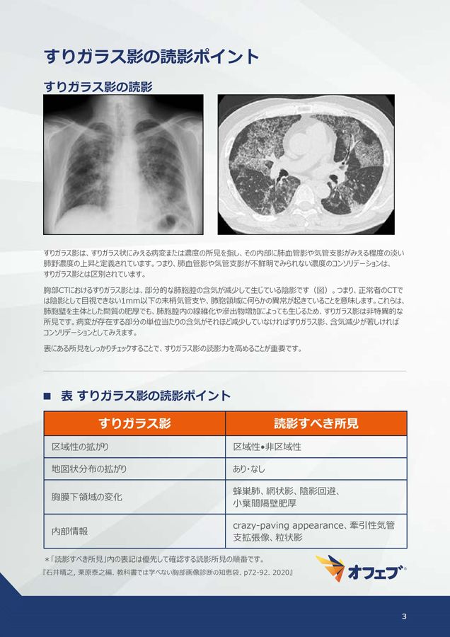 オフェブ関連コンテンツ 間質性肺疾患画像アトラス 画像読影の