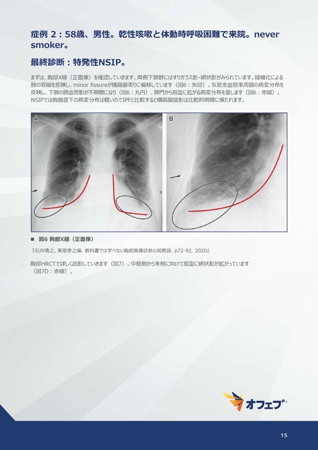 腹部アトラス 症例編 コンパクト超音波シリーズ 腹部アトラス［症例編］ - メルカリ