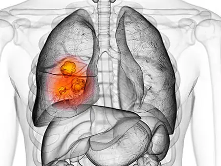 二十世紀の疫病―低血糖症―心身を蝕む恐るべき食原病 二十世紀の疫病―低血糖症―心身を蝕む恐るべき食