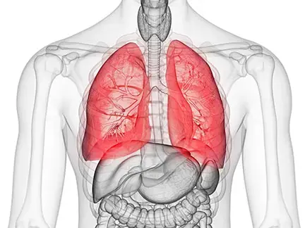 特発性肺線維症