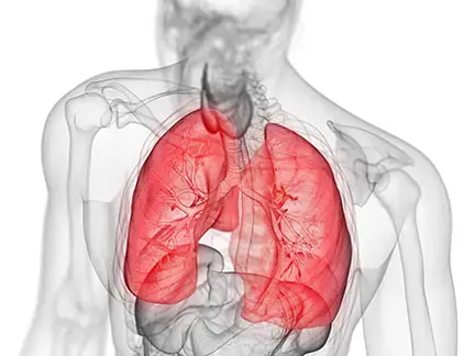 進行性線維化を伴う間質性肺疾患